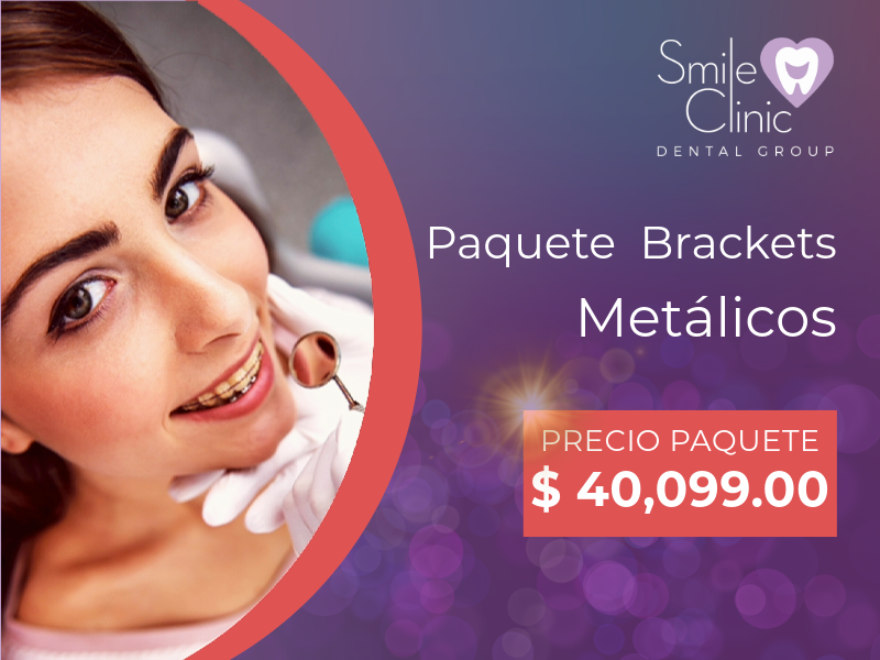 Paquete Brackets